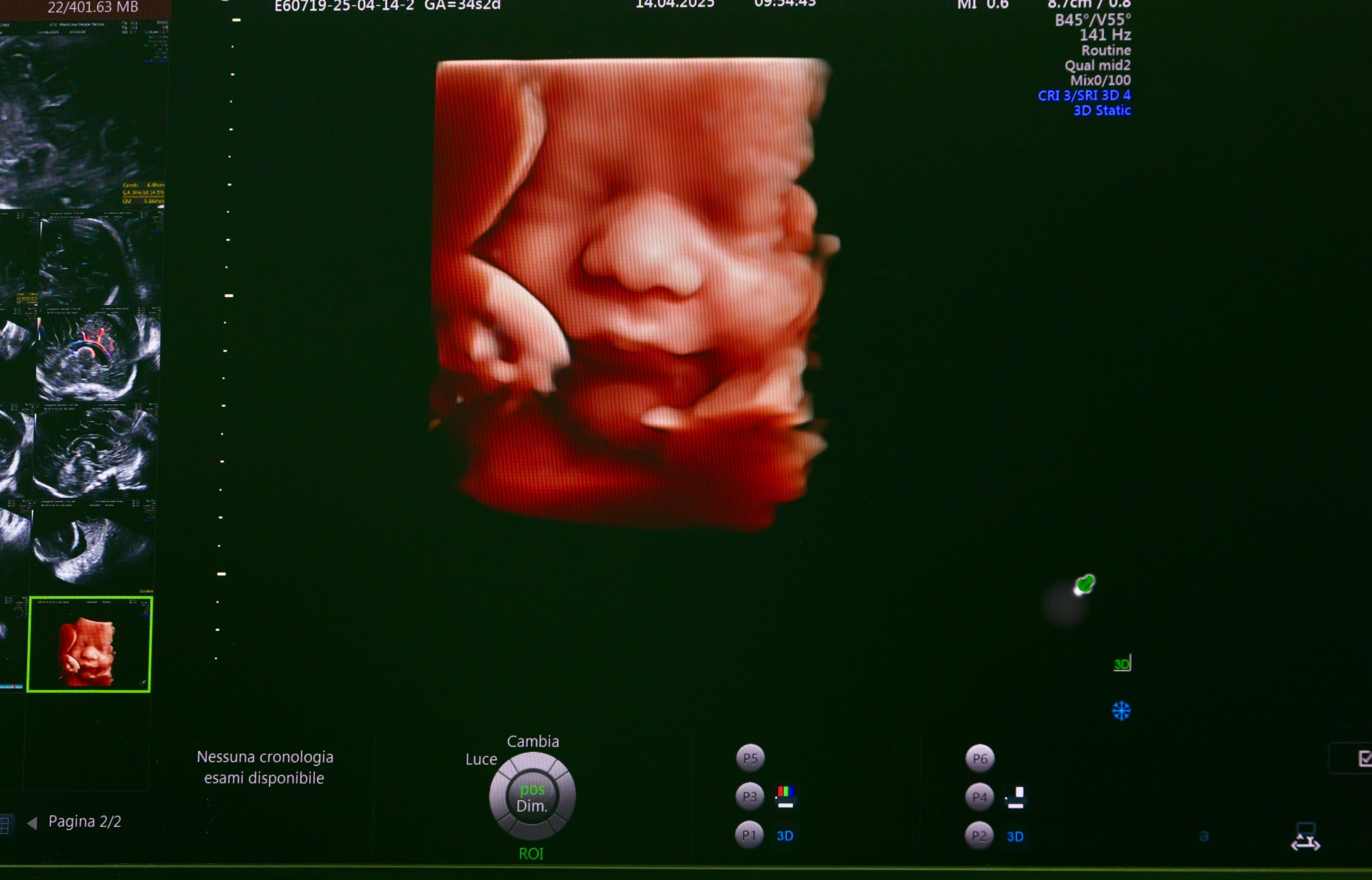 Galleria Casa della Comunità, Medicina fetale, grandi macchine e medici di famiglia: il percorso di rafforzamento del Presidio Post Acuzie Integrato di Terlizzi (Ba) - Diapositiva 8 di 17